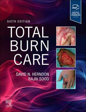 Total Burn Care de David Herndon