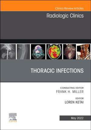 Thoracic Infections, An Issue of Radiologic Clinics of North America de Loren Ketai