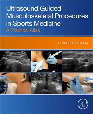 Ultrasound Guided Musculoskeletal Procedures in Sports Medicine: A Practical Atlas de Dinesh Sirisena