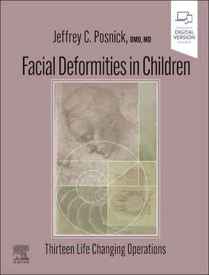 Facial Deformities in Children: Thirteen Life Changing Operations de Jeffrey C. Posnick