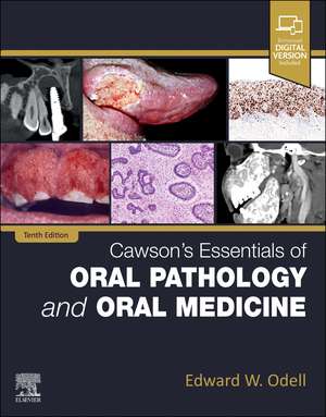 Cawson's Essentials of Oral Pathology and Oral Medicine de Edward W Odell