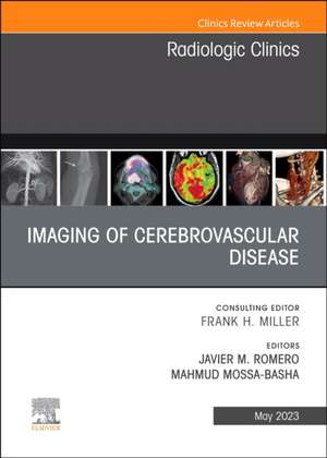 Imaging of Cerebrovascular Disease, An Issue of Radiologic Clinics of North America de Javier M. Romero