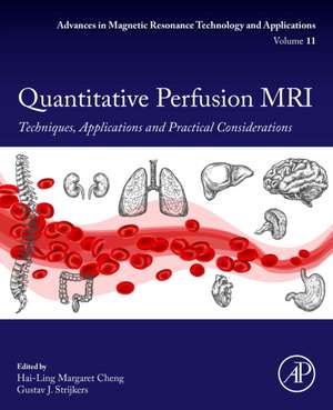 Quantitative Perfusion MRI: Techniques, Applications and Practical Considerations de Hai-Ling Margaret Cheng