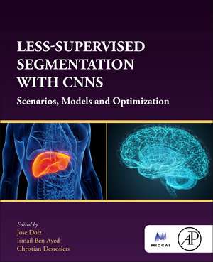 Less-Supervised Segmentation with CNNs: Scenarios, Models and Optimization de Jose Dolz