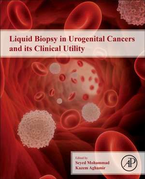 Liquid Biopsy in Urogenital Cancers and its Clinical Utility de Seyed Mohammad Kazem Aghamir