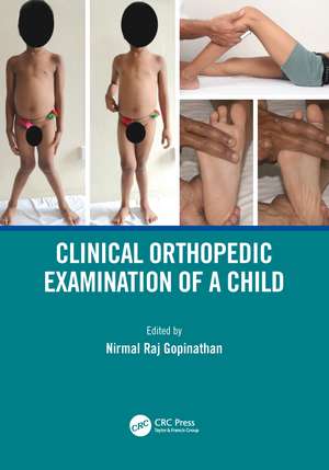 Clinical Orthopedic Examination of a Child de Nirmal Raj Gopinathan