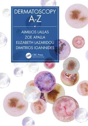 Dermatoscopy A-Z de Dimitrios Ioannides