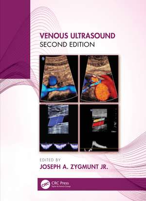 Venous Ultrasound de Joseph Zygmunt