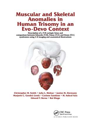 Muscular and Skeletal Anomalies in Human Trisomy in an Evo-Devo Context: Description of a T18 Cyclopic Fetus and Comparison Between Edwards (T18), Patau (T13) and Down (T21) Syndromes Using 3-D Imaging and Anatomical Illustrations de Rui Diogo