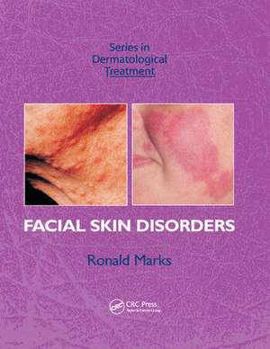 Facial Skin Disorders de Ronald Marks