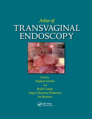 Atlas of Transvaginal Endoscopy de Stephan Gordts