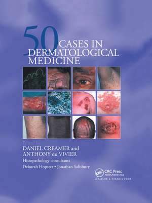 Fifty Dermatological Cases de Daniel Creamer