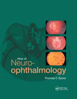 Atlas of Neuro-ophthalmology de Thomas C. Spoor