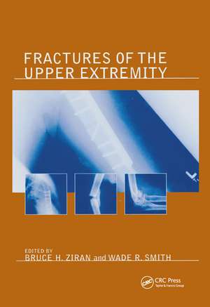 Fractures of the Upper Extremity de Bruce H. Ziran