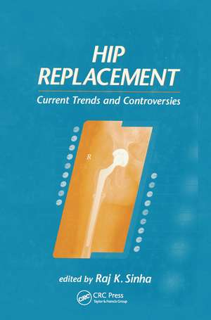 Hip Replacement: Current Trends and Controversies de Raj K. Sinha