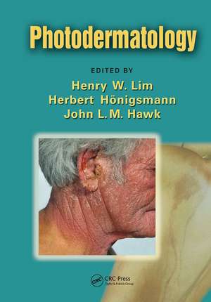 Photodermatology de Henry W. Lim