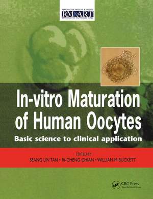 In Vitro Maturation of Human Oocytes de Seang Lin Tan