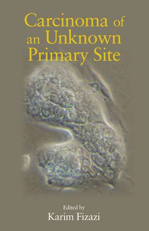 Carcinoma of an Unknown Primary Site de Karim Fizazi