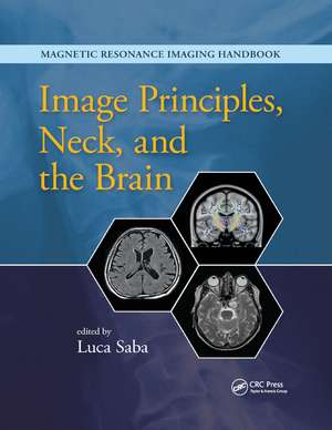 Image Principles, Neck, and the Brain de Luca Saba