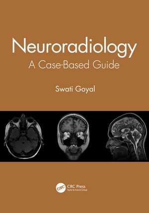 Neuroradiology: A Case-Based Guide de Swati Goyal