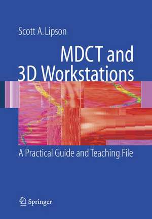 MDCT and 3D Workstations: A Practical How-To Guide and Teaching File de Scott A. Lipson