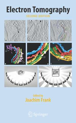 Electron Tomography: Methods for Three-Dimensional Visualization of Structures in the Cell de Joachim Frank