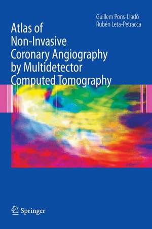 Atlas of Non-Invasive Coronary Angiography by Multidetector Computed Tomography de Guillem Pons-Llado