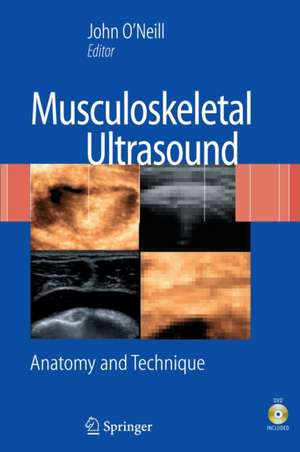 Musculoskeletal Ultrasound: Anatomy and Technique de John M. D. O'Neill