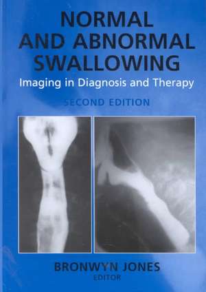 Normal and Abnormal Swallowing: Imaging in Diagnosis and Therapy de Bronwyn Jones