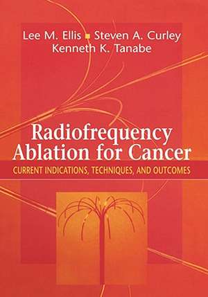 Radiofrequency Ablation for Cancer: Current Indications, Techniques, and Outcomes de Lee M. Ellis