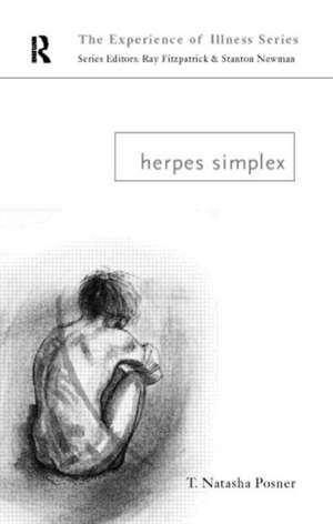 Herpes Simplex de T. Natasha Posner