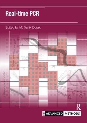 Real-time PCR de M Dorak