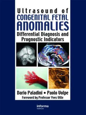 ULTRASOUND OF CONGENITAL FETAL