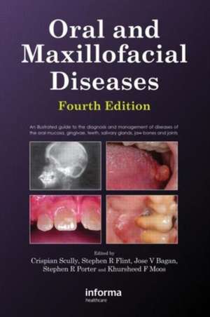 Oral and Maxillofacial Diseases, Fourth Edition de Crispian Scully