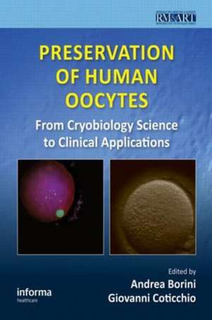 Preservation of Human Oocytes: From Cryobiology Science to Clinical Applications de Andrea Borini