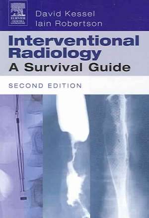 Interventional Radiology: A Survival Guide de David Kessel