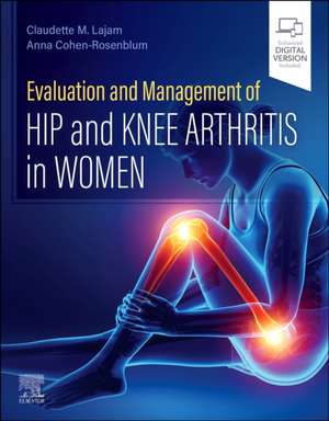 Evaluation and Management of Hip and Knee Arthritis in Women de Claudette M. Lajam