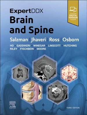 ExpertDDx: Brain and Spine de Karen L. Salzman