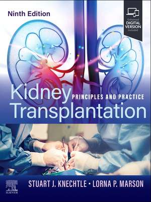 Kidney Transplantation: Principles and Practice de Stuart J. Knechtle