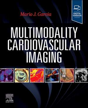 Multimodality Cardiovascular Imaging de Mario J. Garcia