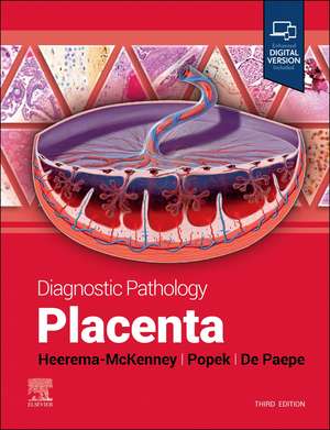 Diagnostic Pathology: Placenta de Amy Heerema-McKenney