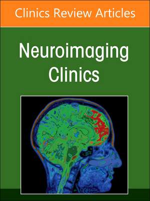 Multiple Sclerosis and Associated Demyelinating Disorders, An Issue of Neuroimaging Clinics of North America de Frederik Barkhof