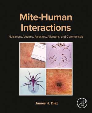 Mite-Human Interactions: Nuisances, Vectors, Parasites, Allergens, and Commensals de James H. Diaz