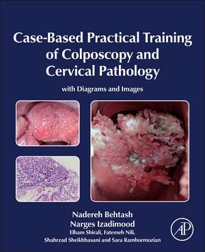 Case-Based Practical Training of Colposcopy and Cervical Pathology: With Diagrams and Images de Nadereh Behtash