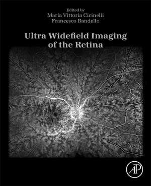 Ultra Widefield Imaging of the Retina de Maria Vittoria Cicinelli