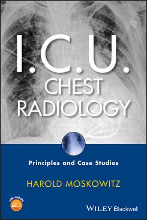 I.C.U. Chest Radiology – Principles and Case Studies +CD de H Moskowitz