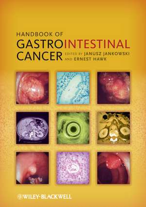 Handbook of Gastrointestinal Cancer 2e de J Jankowski