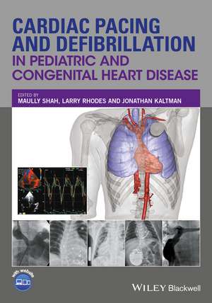 Cardiac Pacing and Defibrillation in Pediatric and Congenital Heart Disease de M Shah