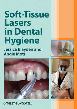 Soft–Tissue Lasers in Dental Hygiene de J Blayden