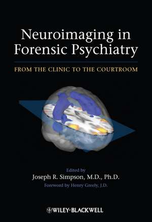 Neuroimaging in Forensic Psychiatry – From the Clinic to the Courtroom de JR Simpson